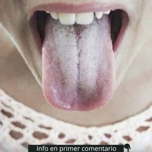 El Misterio de la Lengua Blanca: ¿Qué Significa Realmente y Cuándo Debes Preocuparte?